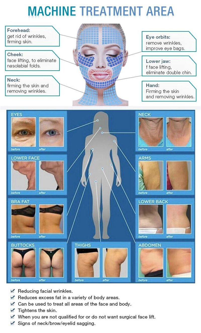 Equipo NEO portátil, máquina de adelgazamiento, celulitis ultrasónica, eliminación de arrugas, Estiramiento facial, 2 asas, máquina reductora de grasa Ultra 360