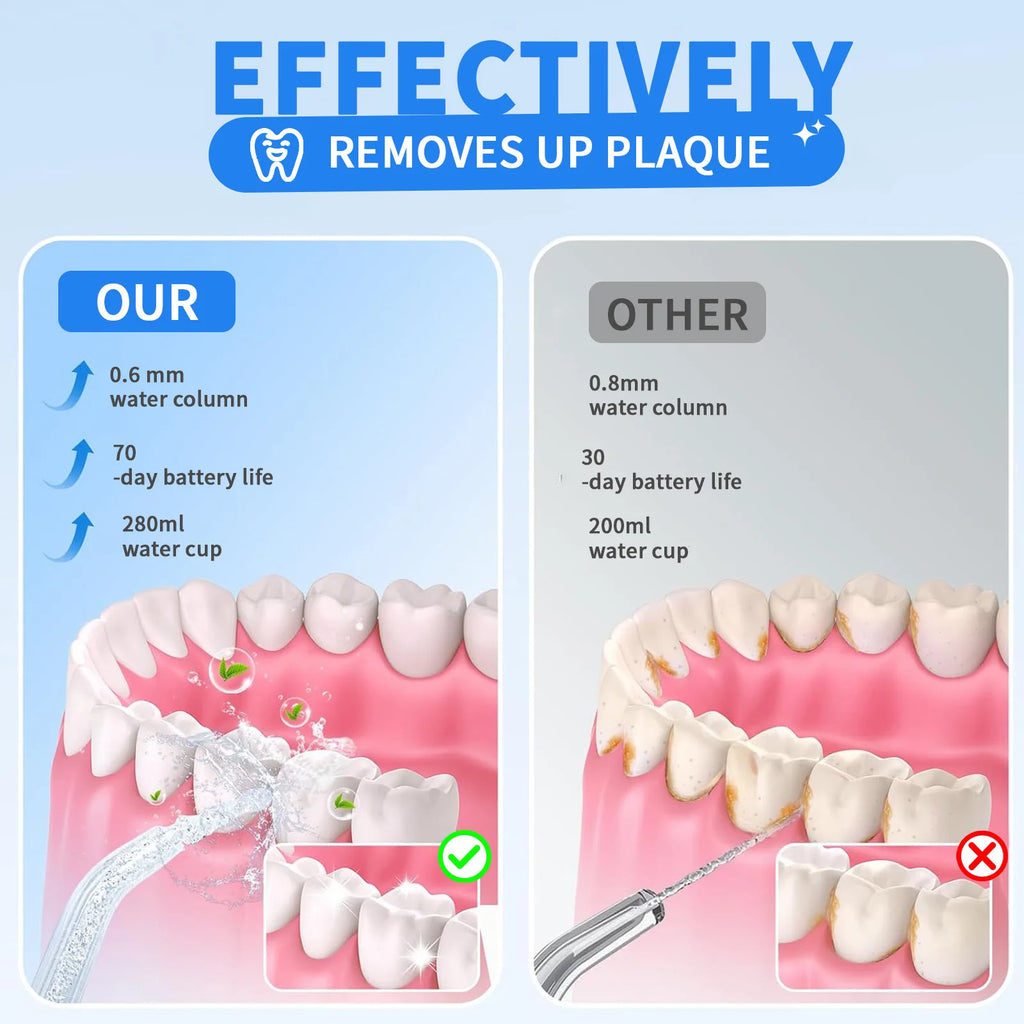 Irrigador Dental Eléctrico para Hogar – Limpiador Bucal con 5 Modos y Tanque Grande, Chorro de Agua Ajustable para Cuidado de Encías y Dientes, Incluye Boquillas