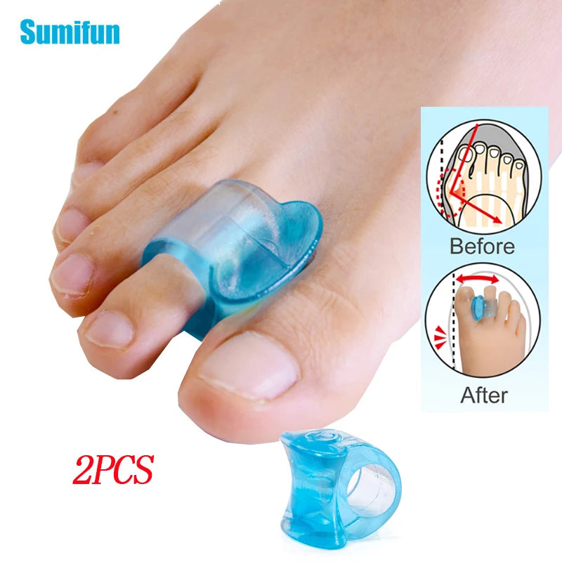 Separador de dedos de los pies de Gel azul, herramienta para el cuidado de los pies, alisador de juanetes de silicona, Protector de juanete Hallux Valgus, alineación, 2 uds.