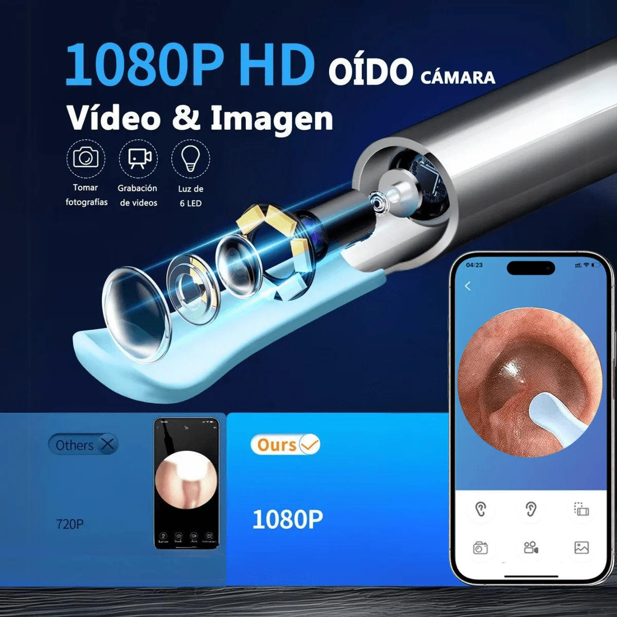 Cucharilla para limpiar oídos con cámara: cámara HD de 2 megapíxeles, cucharilla para oídos ultra HD visible, herramienta de limpieza para el canal auditivo con kit de limpieza, visualización en el teléfono móvil, lim