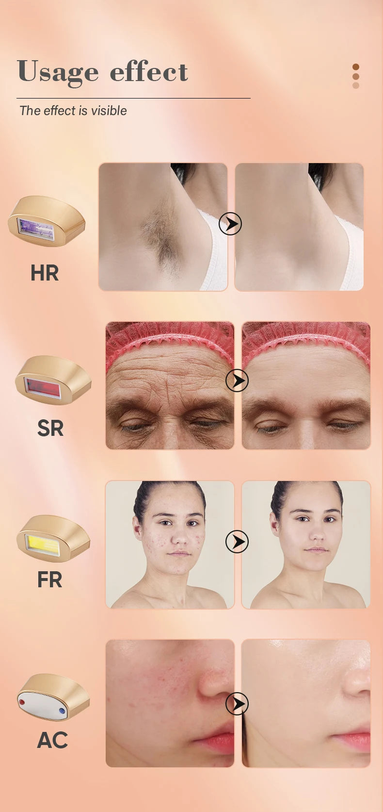 KODO 2026 Depiladora Láser de Hielo de Alta Gama, Personalizable, Depilación Láser Permanente IPL, Fotoepiladora Indolora 4 en 1 para Rostro y Cuerpo