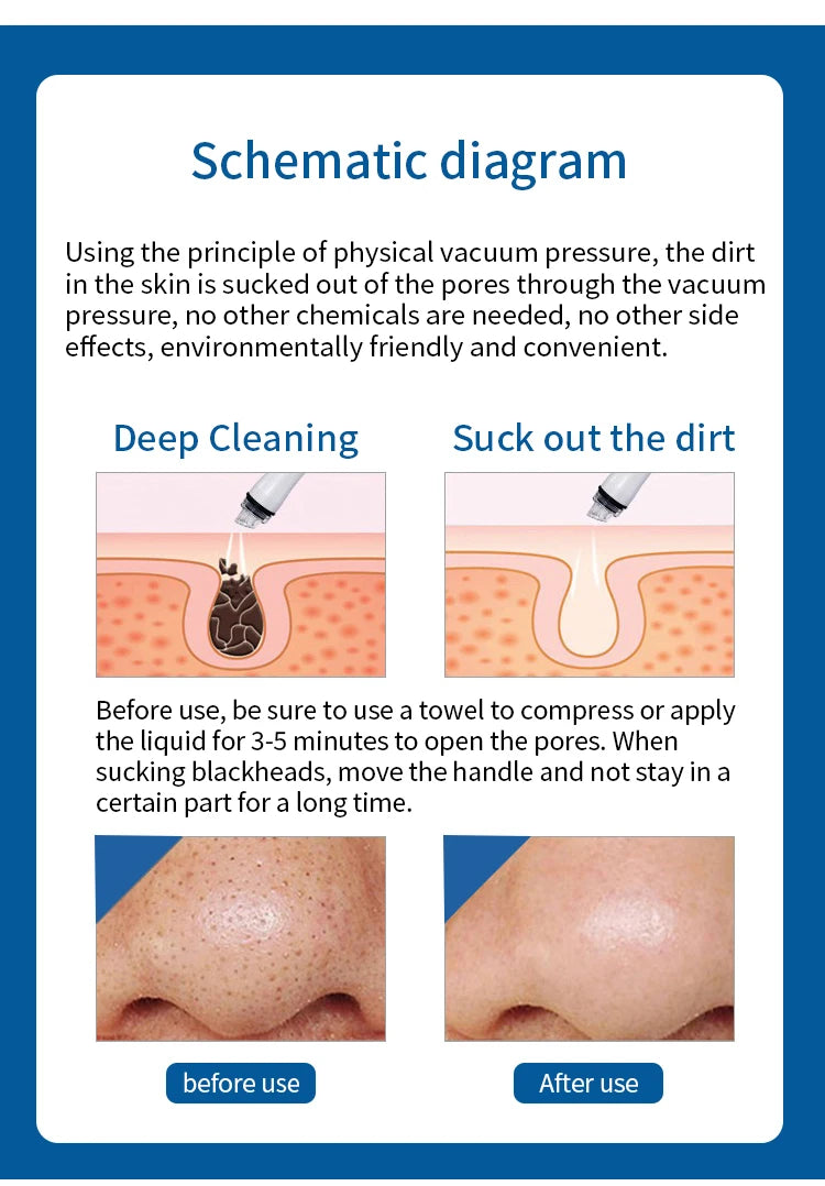 7 en 1 Analizador inteligente de azul hielo Máquina facial multifunción Diamond Hydra Dermoabrasión Facial Aquafacial
