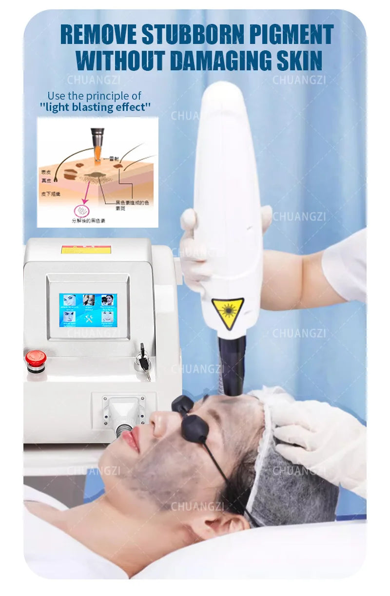 Máquina de Belleza Láser Más Vendida, Láser Portátil Q-switch ND YAG para Eliminación de Tatuajes, Eliminación de Pigmentación, Máquina de Peeling de Carbono