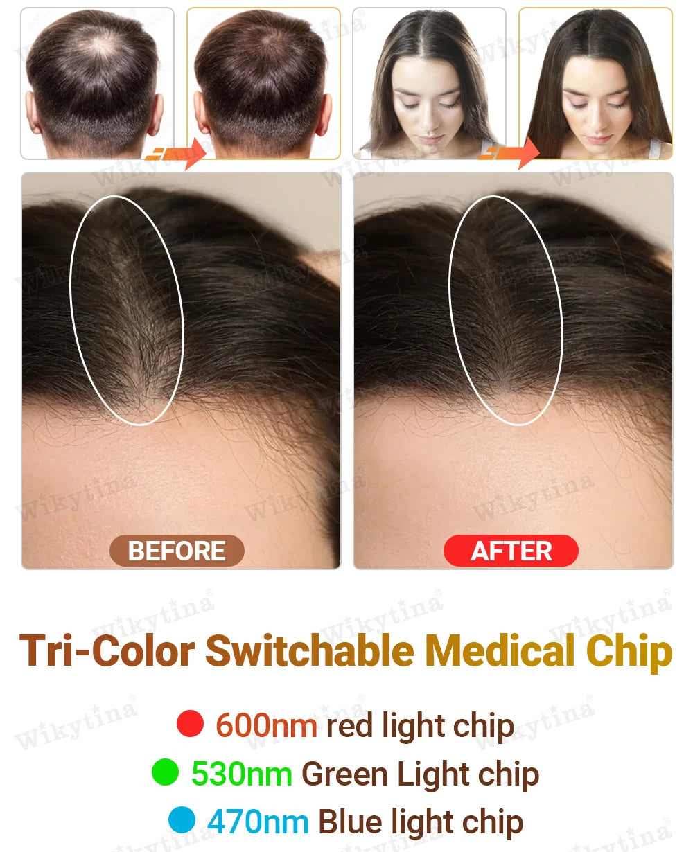 Plancha de Pelo Profesional con Iones Negativos, Calentamiento Rápido, Placas de Titanio, Temperatura Ajustable, Anti-Frizz, Alisador de Pelo Suave