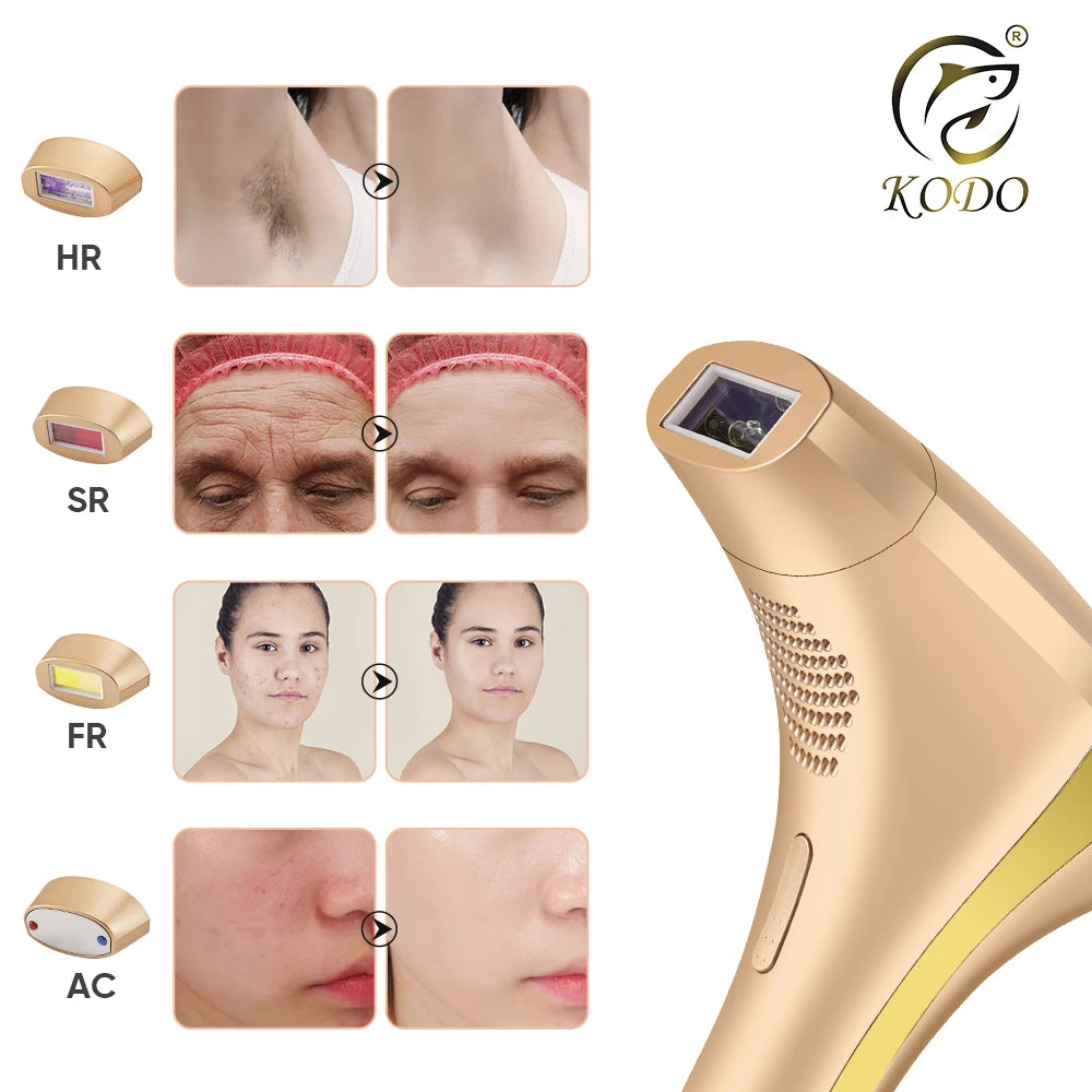 KODO 2026 Depiladora Láser de Hielo de Alta Gama, Personalizable, Depilación Láser Permanente IPL, Fotoepiladora Indolora 4 en 1 para Rostro y Cuerpo