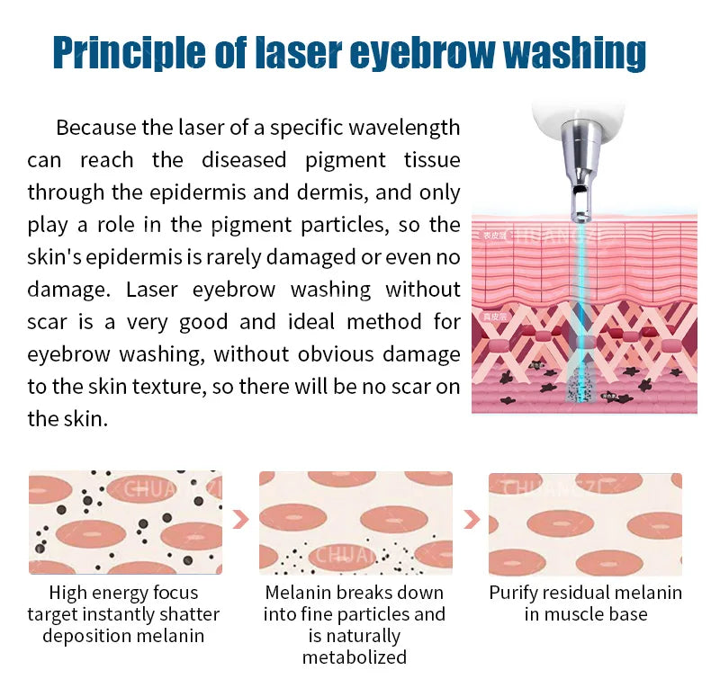 Máquina de Belleza Láser Más Vendida, Láser Portátil Q-switch ND YAG para Eliminación de Tatuajes, Eliminación de Pigmentación, Máquina de Peeling de Carbono