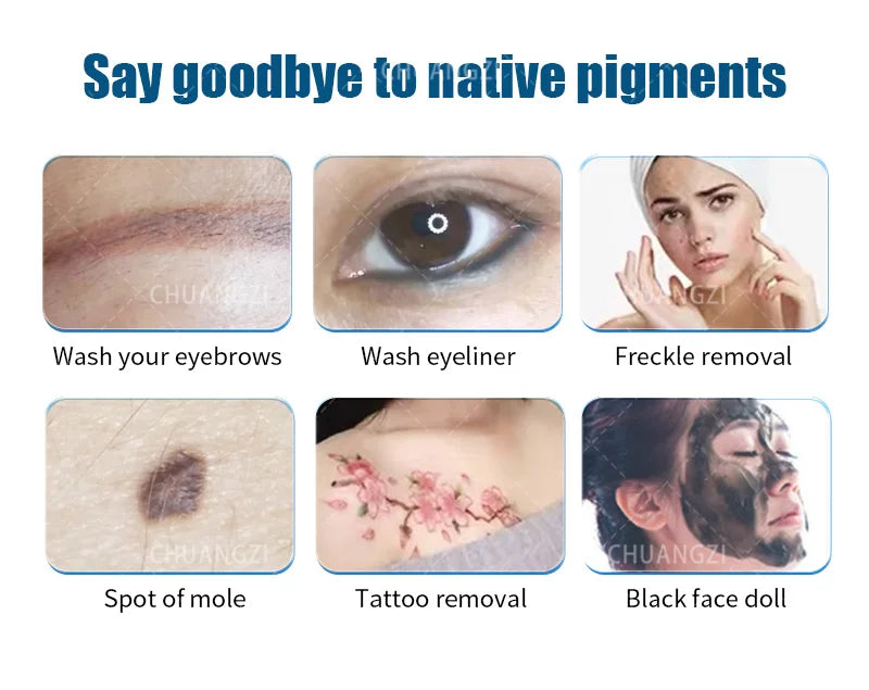 Máquina de Belleza Láser Más Vendida, Láser Portátil Q-switch ND YAG para Eliminación de Tatuajes, Eliminación de Pigmentación, Máquina de Peeling de Carbono